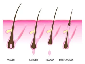 Haarwuchs durch Haartransplantation: 3 Vorteile