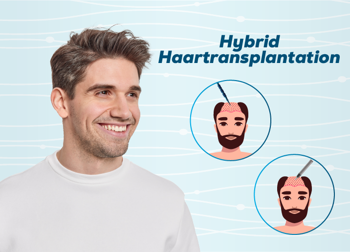 Hybrid Haartransplantation Türkei Antalya