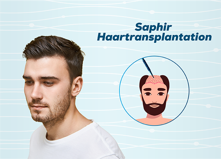 Saphir Haartransplantation Türkei Antalya